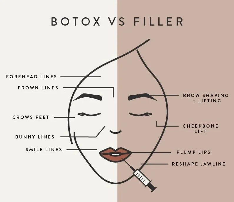 Botox Vs Fillers | Comparison