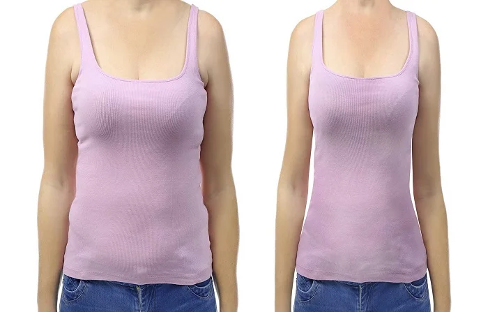 Breast Reduction before and after