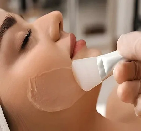 Glycolic Peel Treatment in Dubai