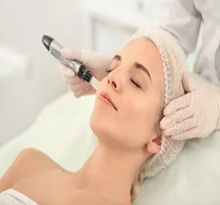 Microneedling Treatment in Dubai