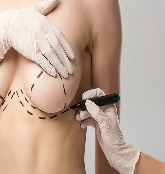 Brava breast augmentation in Dubai