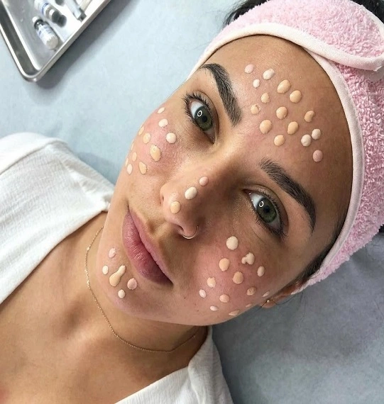 BB Glow Treatment in Dubai