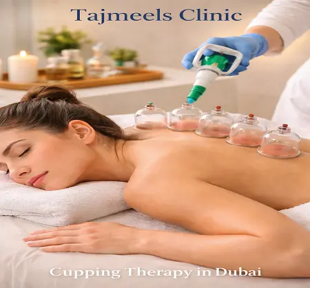 Cupping Therapy in Dubai