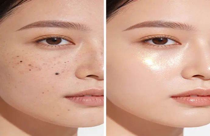 Diamond Peeling in Dubai before after