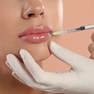 The Cost of Lip Filler Injections in the UAE