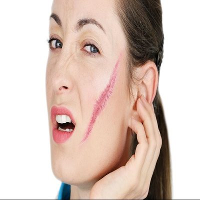 Facial Scar Revision Cost in Dubai