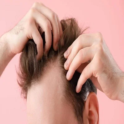 Finasteride for hair transplantation in the UAE