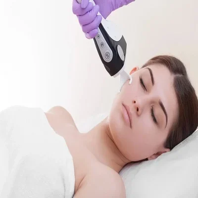 Fractional CO2 Laser Treatment in Dubai