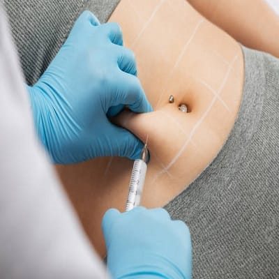 What Areas are Treated with Fat Dissolving Injections