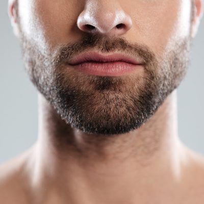 Beard Hair Transplant in Dubai