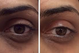 أصبحت الهالات السوداء في دبي وأبو ظبي والشارقة والعين (1)