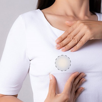 إزالة الورم الغدّي في دبي وأبو ظبي والشارقة والعين