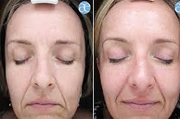 الهيدرافيشل في دبي وأبو ظبي والشارقة والعين