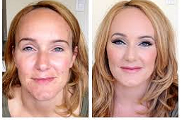 تقنية ريد كاربت للوجه في دبي وأبو ظبي والشارقة