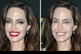 تقنية ريد كاربت للوجه في دبي وأبو ظبي