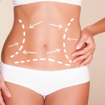 عملية نحت الجسم غير الجراحية في دبي وأبو ظبي والشارقة والعين