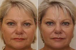 خيوط  APTOS في دبي وأبو ظبي