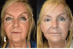 خيوط  APTOS في دبي وأبو ظبي والشارقة