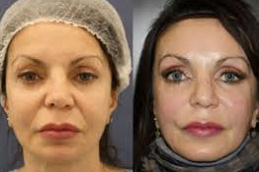 خيوط  APTOS في دبي وأبو ظبي والشارقة والعين