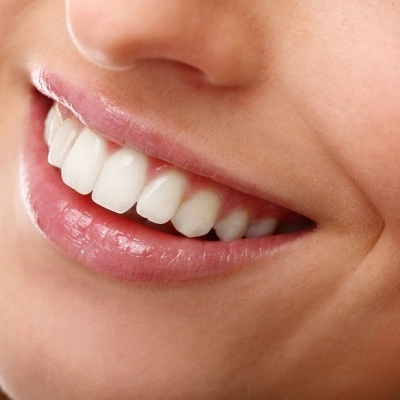 ربط الأسنان في أبوظبي والعين