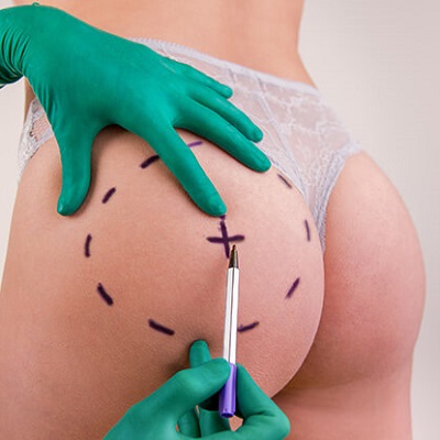 أفضل تكبير المؤخرة في دبي وأبو ظبي والشارقة والعين