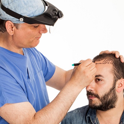 زراعة الشعر بالخلايا الجذعية زراعة الشعر بالخلايا الجذعية في دبي وأبو ظبي والشارقة والعين