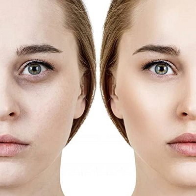 الهالات السوداء في دبي وأبو ظبي والشارقة والعين