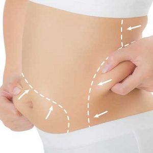 علاج ليبوماتيك في دبي وأبو ظبي والشارقة والعين