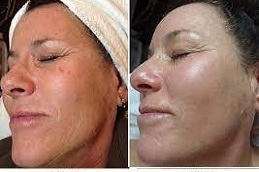 Organic-Pumpkin-Peel-in-Abu-Dhabi