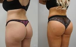 تكلفة تكبير الأرداف في دبي تكلفة تكبير الأرداف في دبي