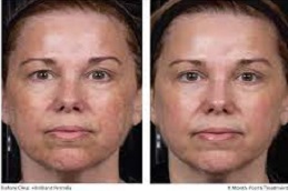 ريد كاربت للوجه في دبي وأبو ظبي والشارقة والعين