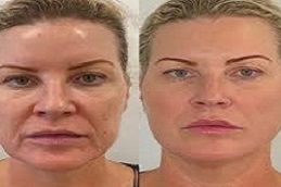 خيوط أبتوس في دبي وأبو ظبي والشارقة والعين  