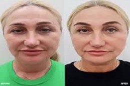 خيوط أبتوس في دبي وأبو ظبي والشارقة والعين  