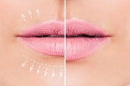 جهاز فوتونا رباعي الأبعاد لتجميل الشفاه في دبي وأبو ظبي والشارقة والعين