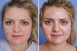 أفضل خبراء التجميل في دبي وأبو ظبي والشارقة والعين