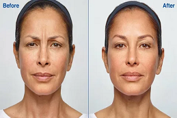 أفضل خبراء التجميل في دبي وأبو ظبي والشارقة والعين