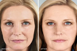 أفضل خبراء التجميل في دبي وأبو ظبي والشارقة والعين