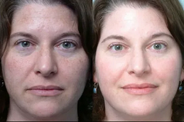 أفضل خبراء التجميل في دبي وأبو ظبي والشارقة والعين