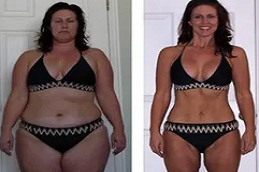 جراحة ما بعد فقدان الوزن في دبي وأبو ظبي والشارقة والعين