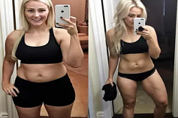 جراحة ما بعد فقدان الوزن في دبي وأبو ظبي والشارقة والعين