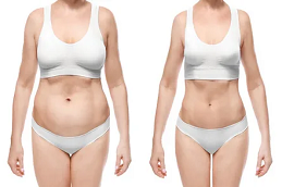 جراحة ما بعد فقدان الوزن في دبي وأبو ظبي والشارقة والعين