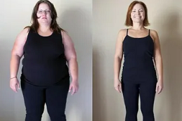 جراحة ما بعد فقدان الوزن في دبي وأبو ظبي والشارقة والعين