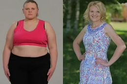 جراحة ما بعد فقدان الوزن في دبي وأبو ظبي والشارقة والعين