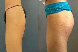 شد الأرداف في دبي وأبو ظبي والشارقة والعين