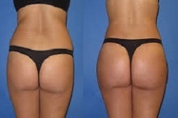 شد الأرداف في دبي وأبو ظبي والشارقة والعين