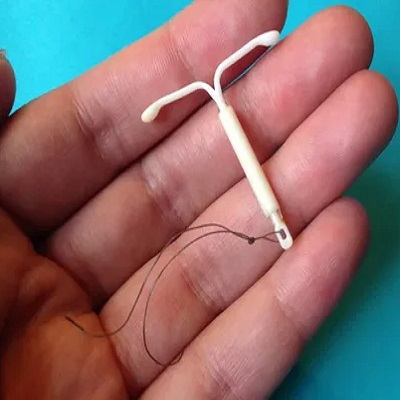 تركيب اللولب ميرينا في دبي وأبوظبي والشارقة والعين