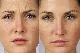 أليرجان بوتوكس في دبي أليرجان بوتوكس في دبي، أبو ظبي