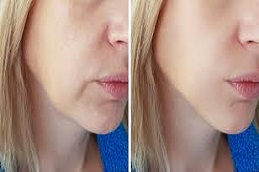 أليرجان بوتوكس في دبي، أبو ظبي