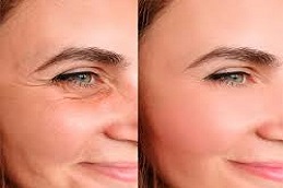 أليرجان بوتوكس في دبي، أبو ظبي