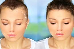 زراعة الشعر للإناث في دبي وأبوظبي والشارقة والعين